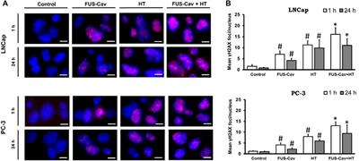 Ultrasound-induced cavitation renders prostate cancer cells susceptible to hyperthermia: Analysis of potential cellular and molecular mechanisms